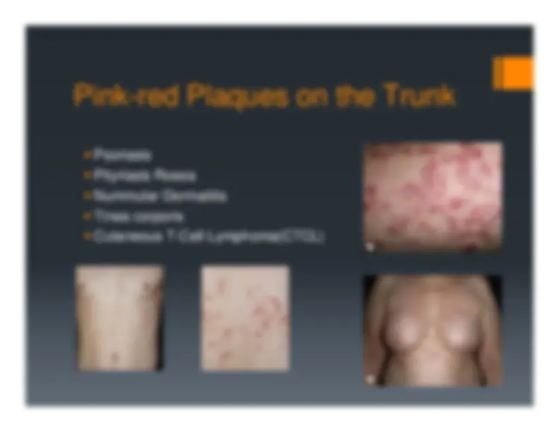 Temple Rash Description, Definition and Diagnosis of Common Skin Rashes | Summaries ...