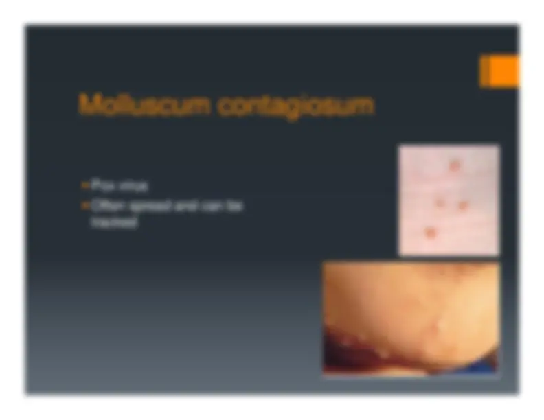 Description, Definition and Diagnosis of Common Skin Rashes | Summaries ...