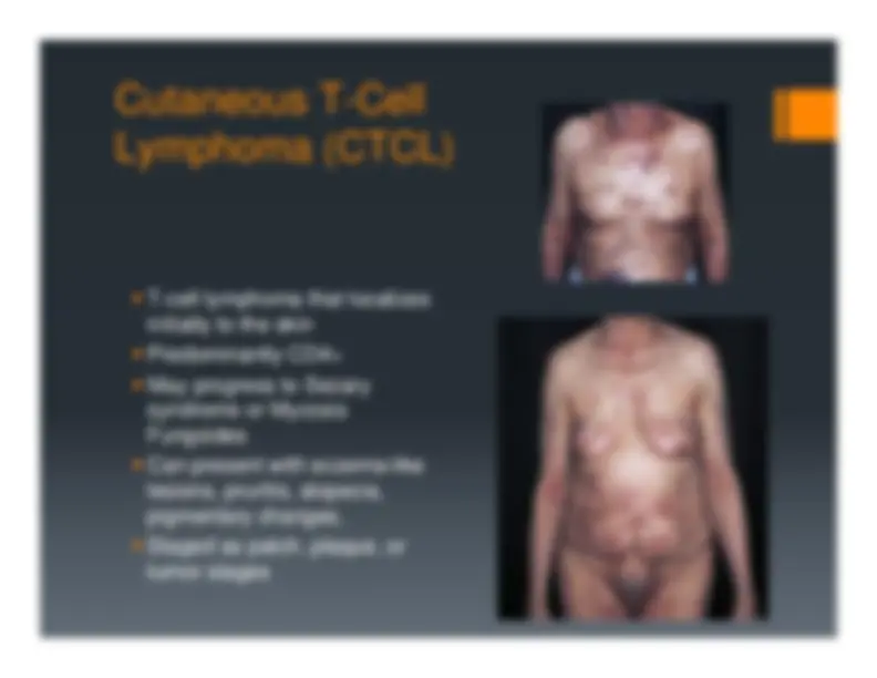Description, Definition and Diagnosis of Common Skin Rashes | Summaries ...