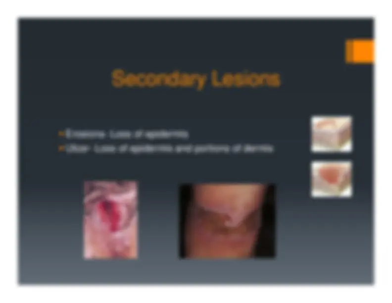 Description, Definition and Diagnosis of Common Skin Rashes | Summaries ...