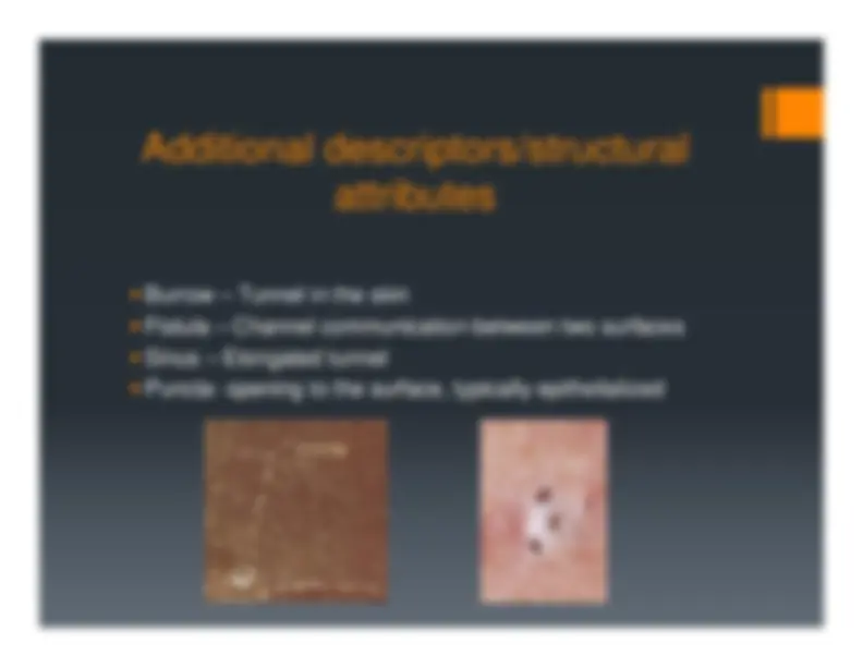 Description, Definition and Diagnosis of Common Skin Rashes | Summaries ...