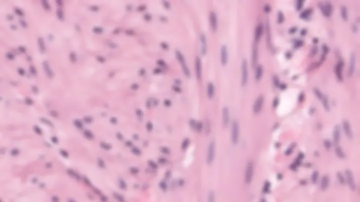 pf2a