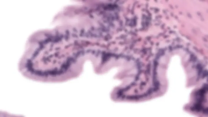 pf26