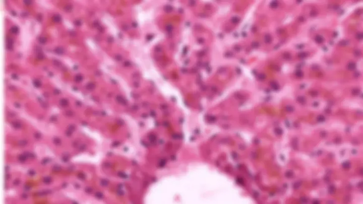 pf1a