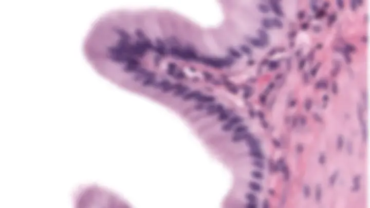 pf27