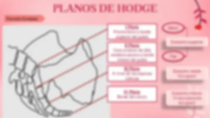 pf14