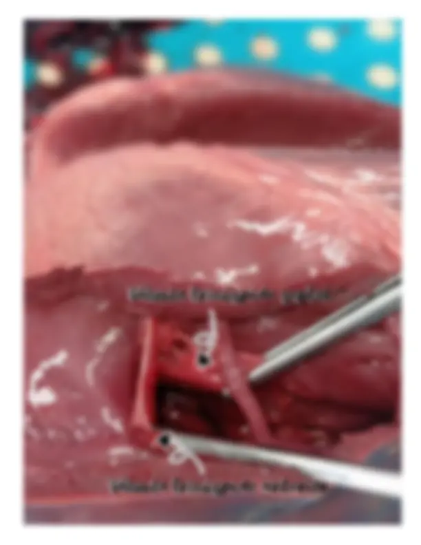 pfa