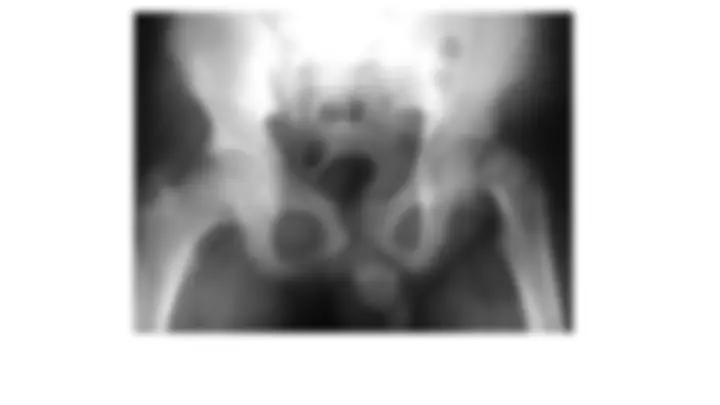 pf59