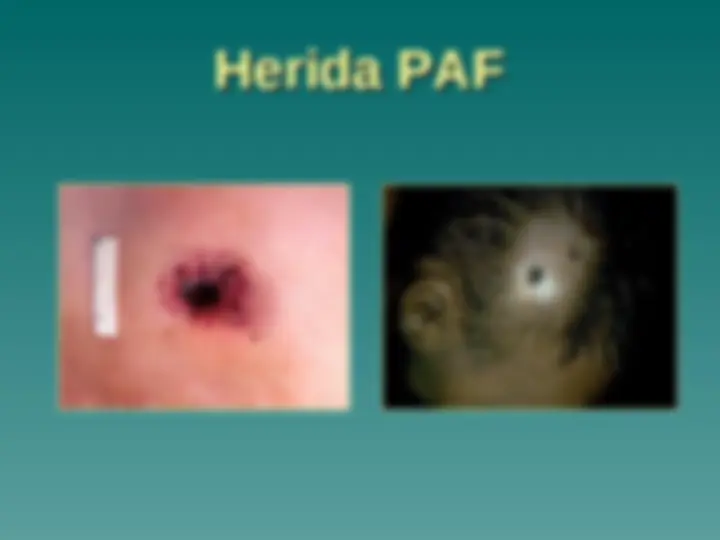 pf31