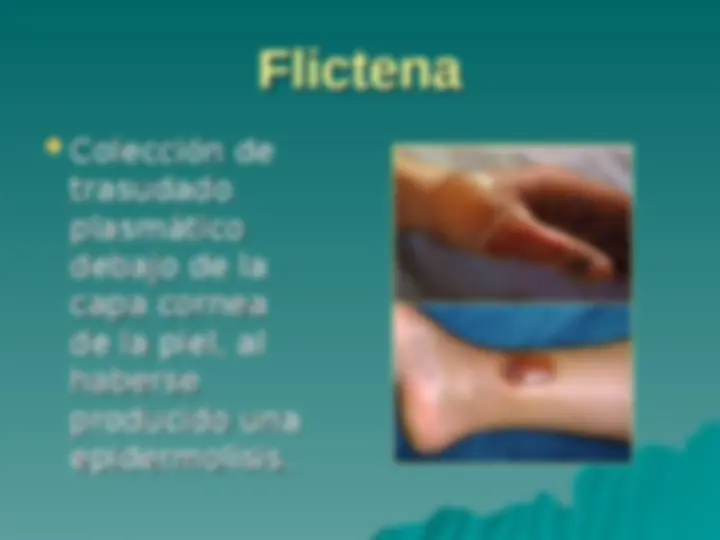 pf19