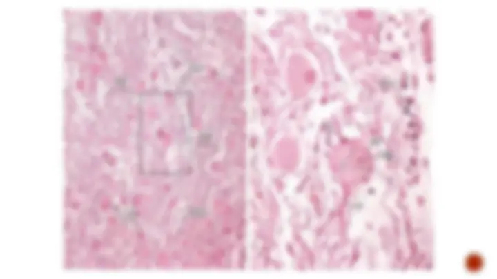 pf29
