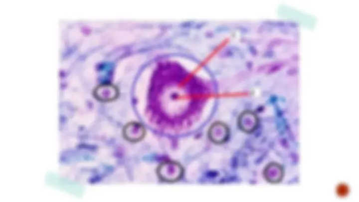 pf25