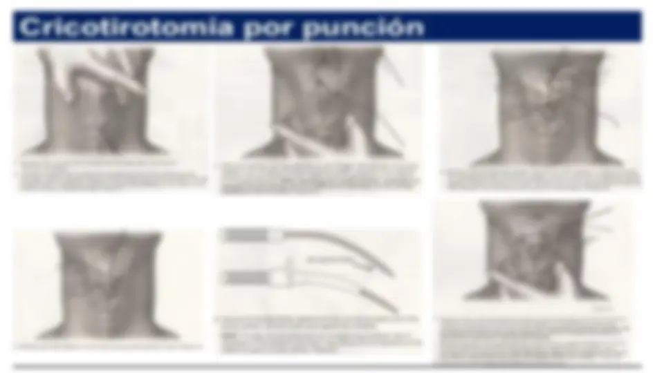 pf14
