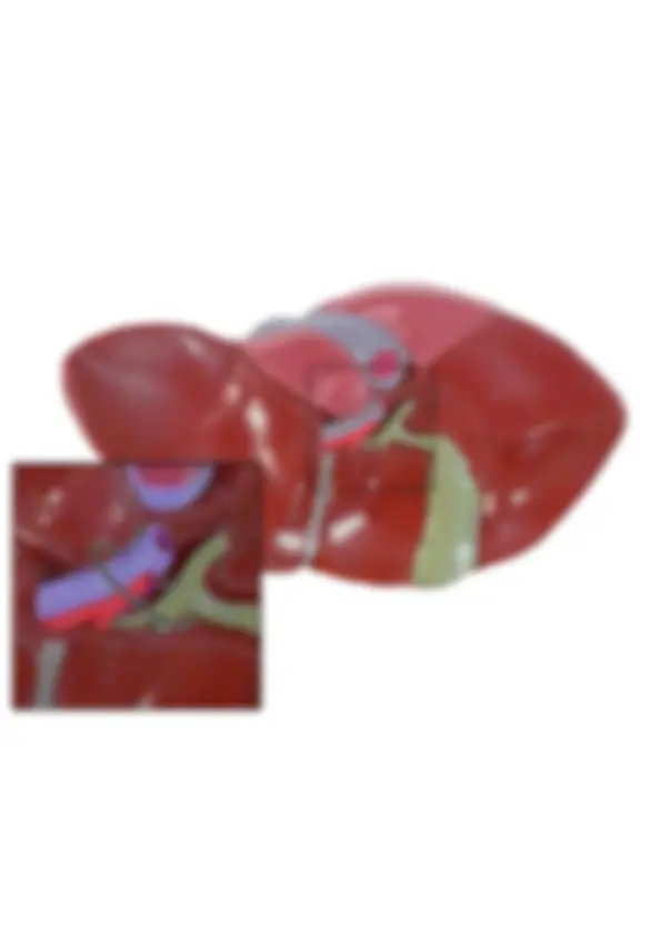 pf1f
