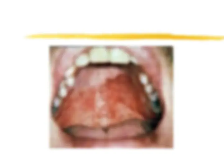 pfe