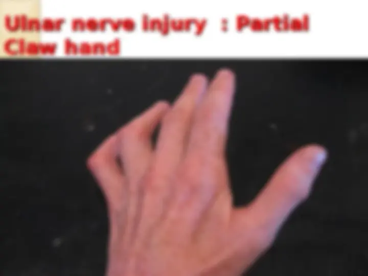 pf33
