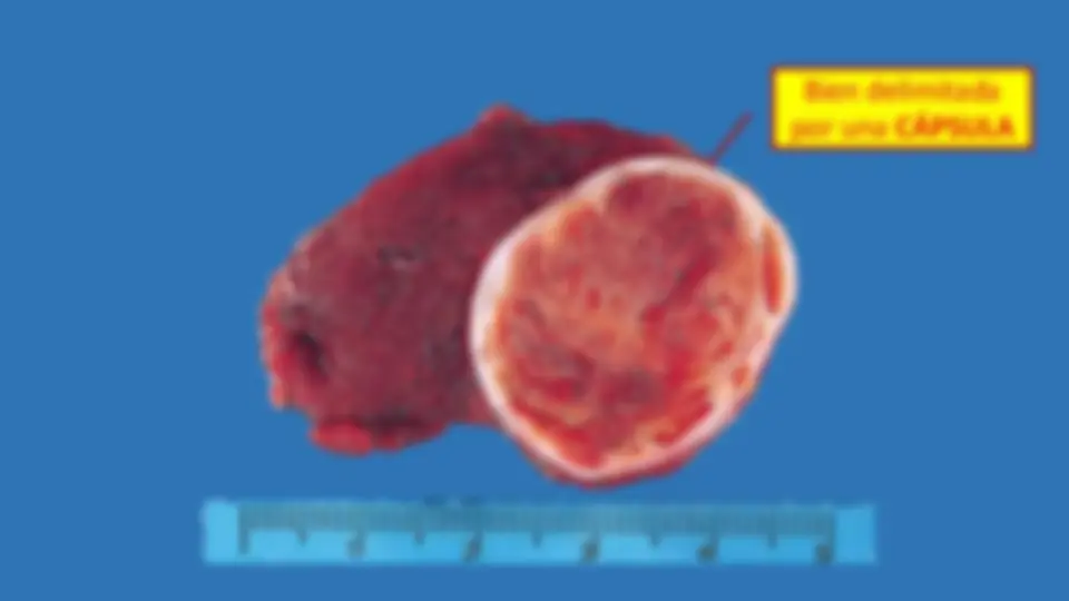 pf37
