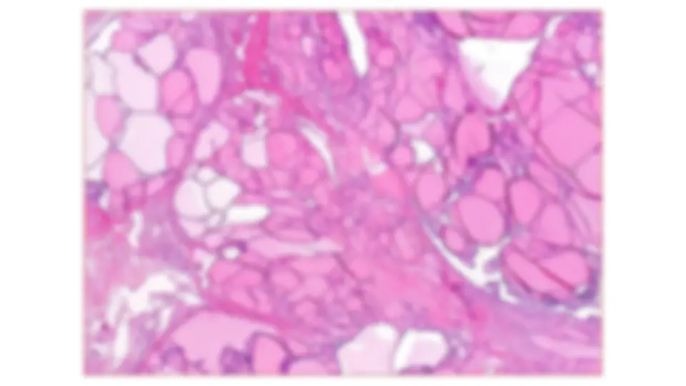 pf34