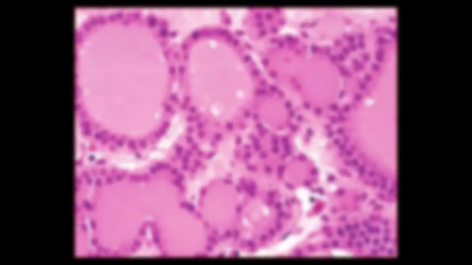 pf38