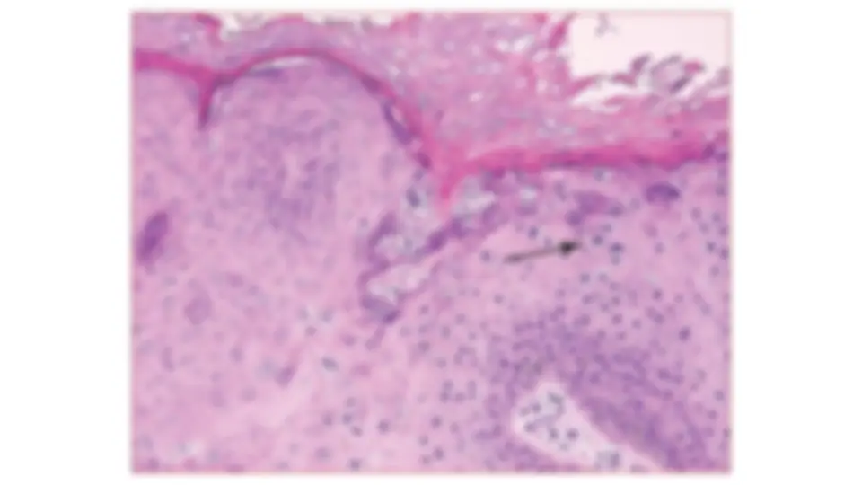 pf5b