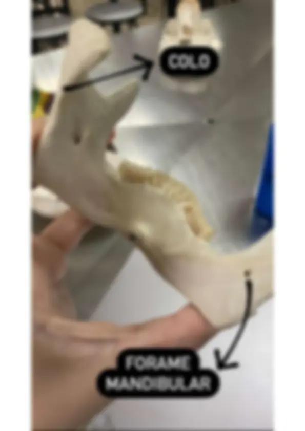pfa