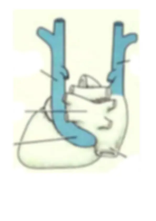pfa