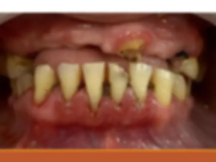 pf3