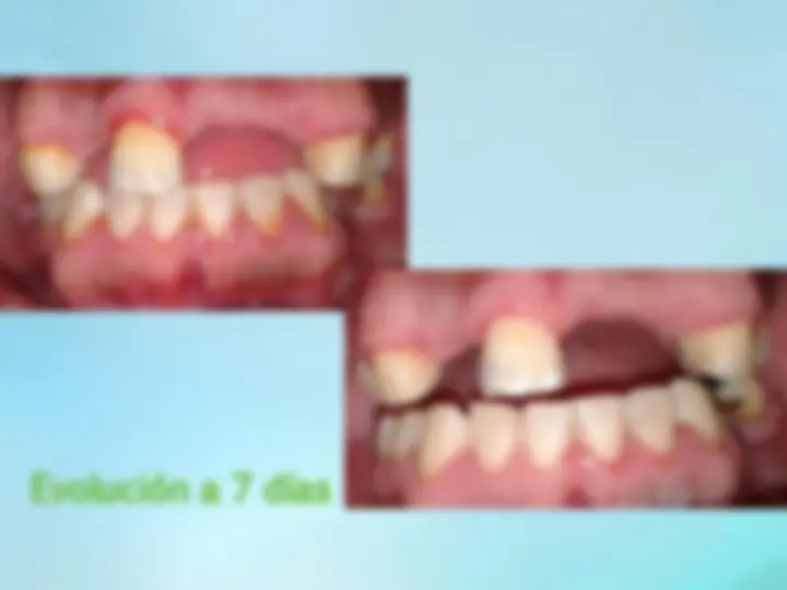 pf1f