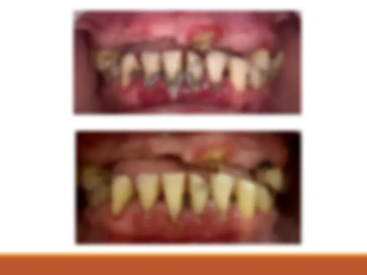 pf4