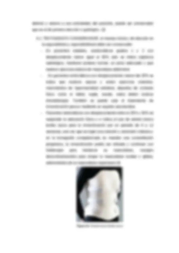 pf13