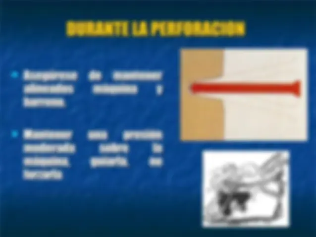 pf1a
