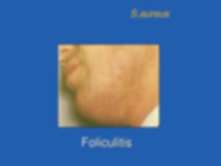 pf18