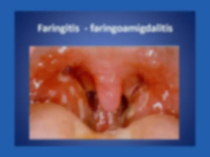 pf13