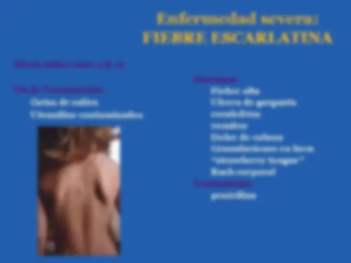 pf18