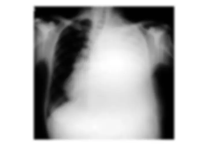 pf5