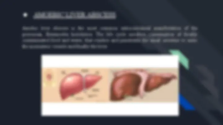 pf5