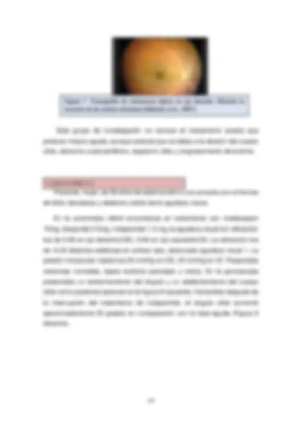 pf17