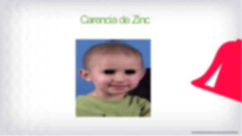 pfe