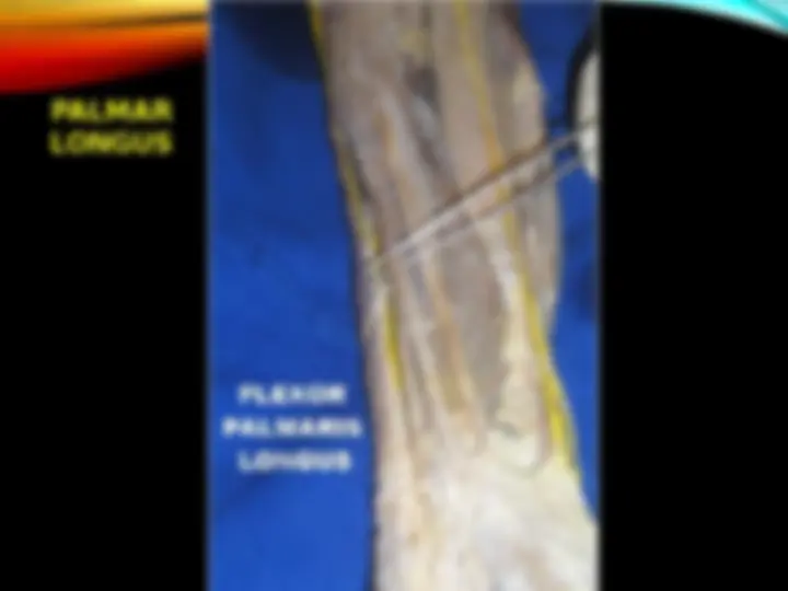 pf27