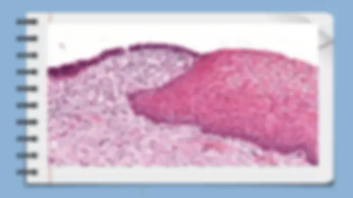pf1b