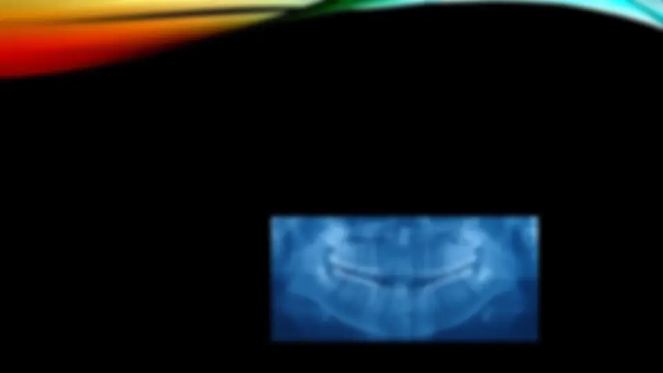 pf4