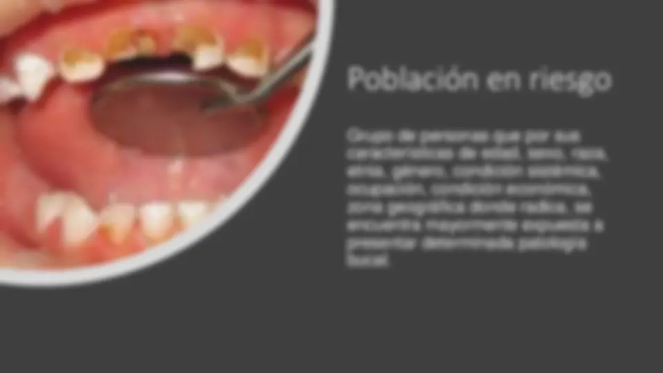 pfe