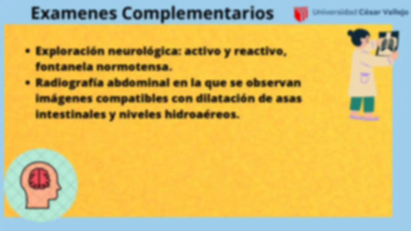 pfe