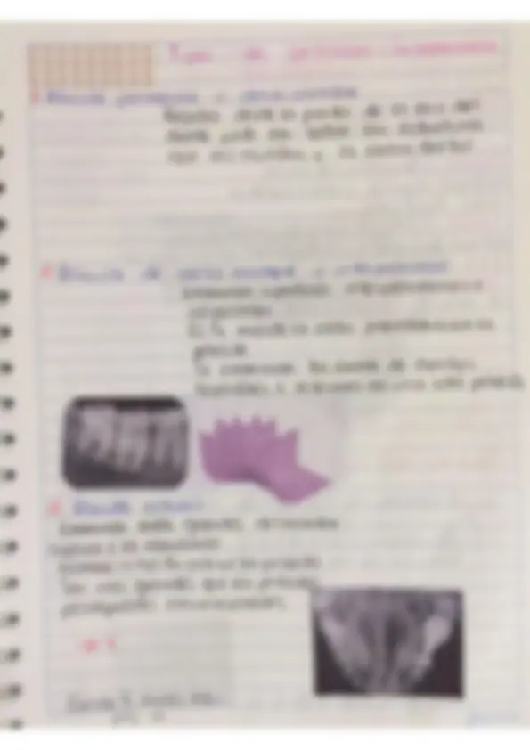 pf14