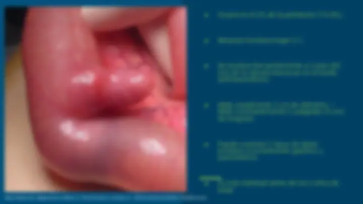 pf4