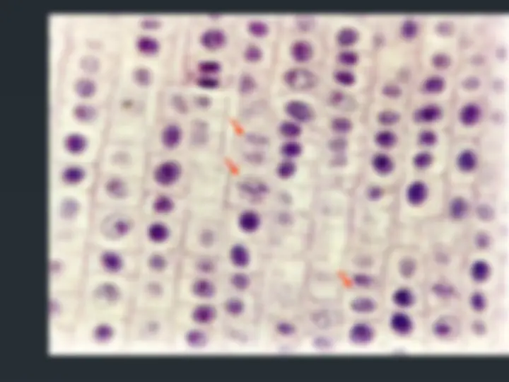 pf20