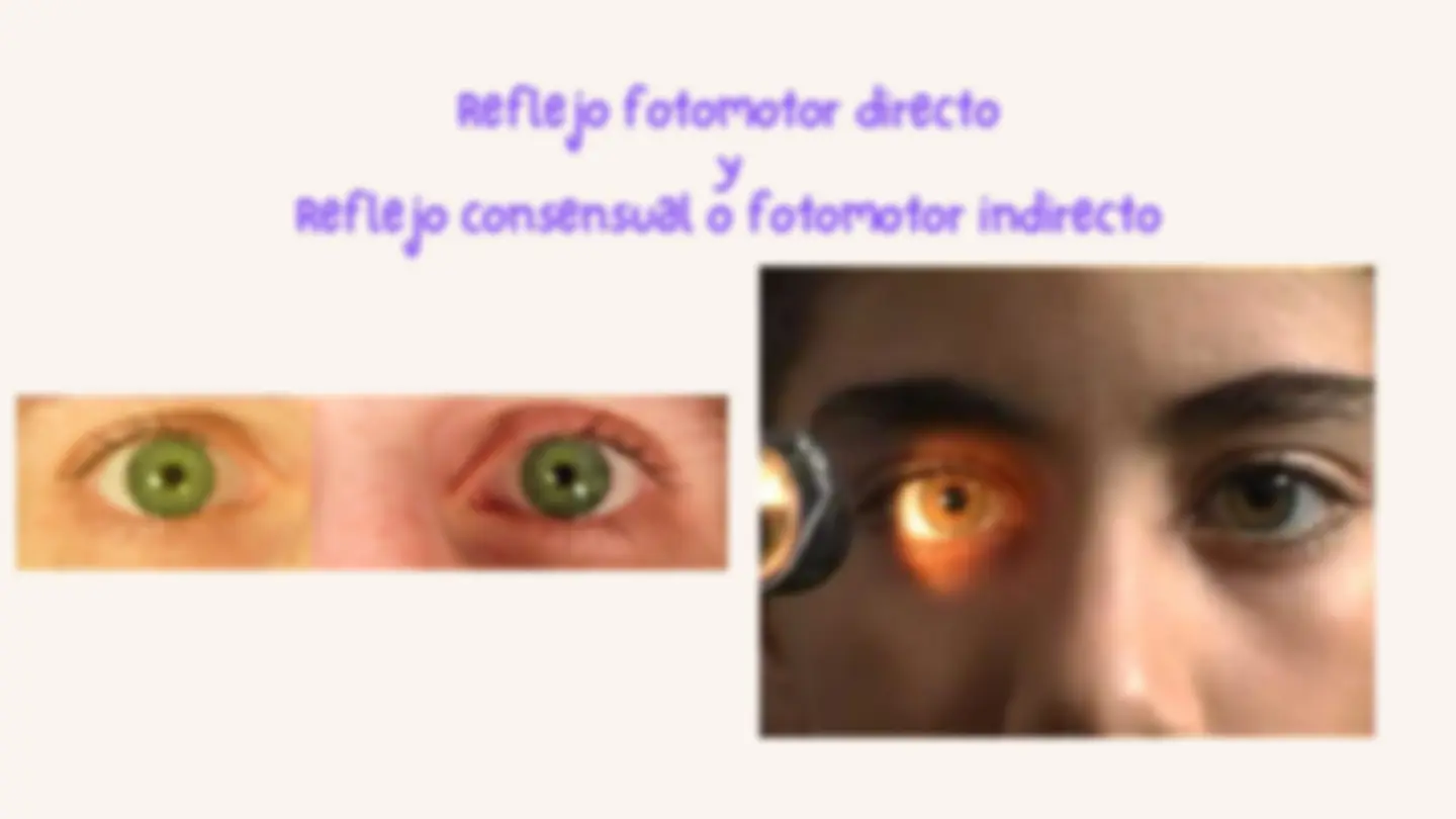 pfe