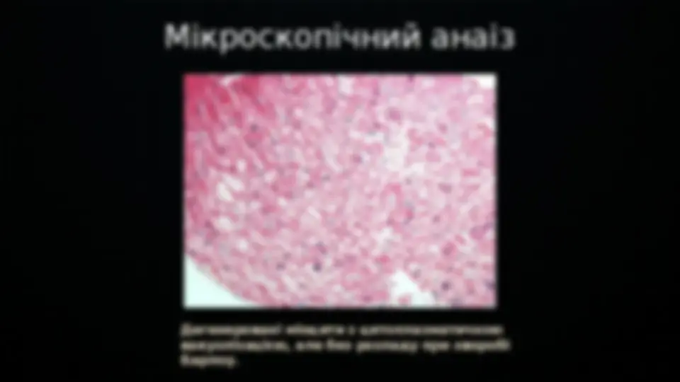 pfa