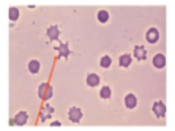 pf45