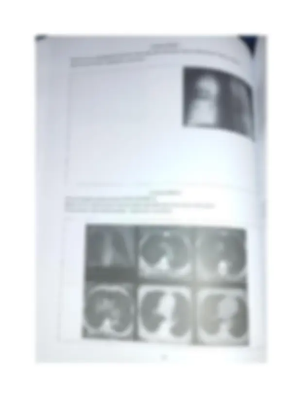 pf5